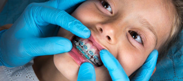 Carlsbad Pediatric Orthodontist