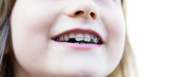 Pediatric Orthodontist Carlsbad