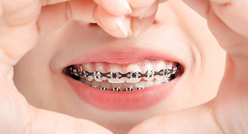 Orthodontist Carlsbad