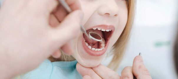 Pediatric Dentistry Carlsbad