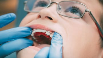 Pediatric Orthodontist Carlsbad