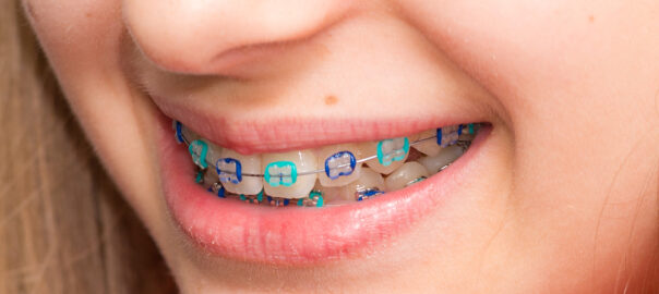 Orthodontist Carlsbad