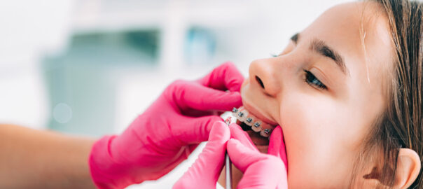 Carlsbad Orthodontist
