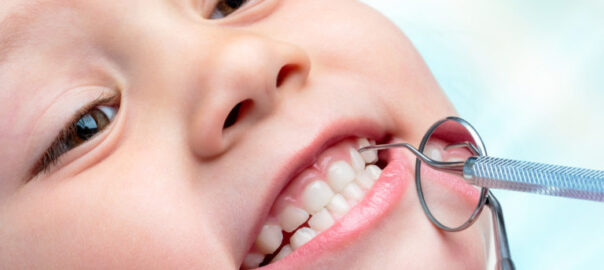 Kids Teeth Cleaning Carlsbad