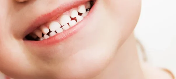 Kids Teeth Cleaning Carlsbad