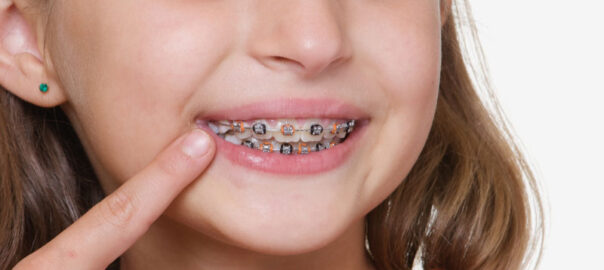 Orthodontist Near Me Carlsbad