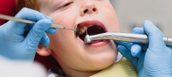 Tooth Fillings For Kids Carlsbad