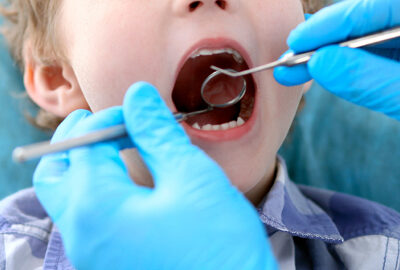 Carlsbad Dentistry For Kids
