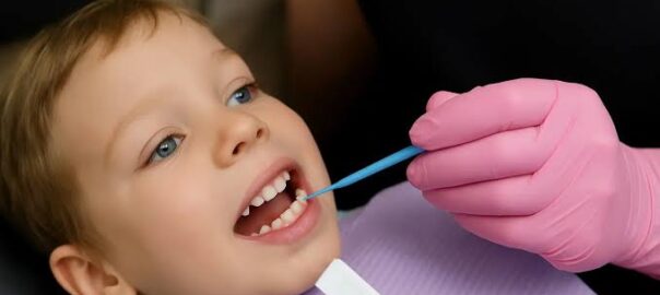 Fluoride Treatments Carlsbad