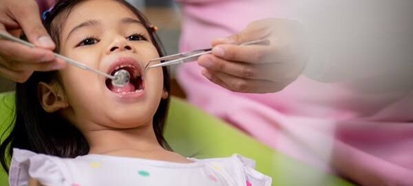Kids Dental Carlsbad
