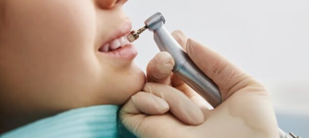 Kids Teeth Cleaning Carlsbad