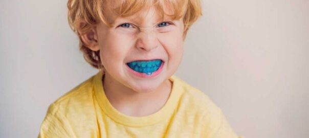 Sport Mouth Guards Carlsbad