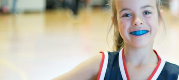 Sport Mouth Guard Carlsbad